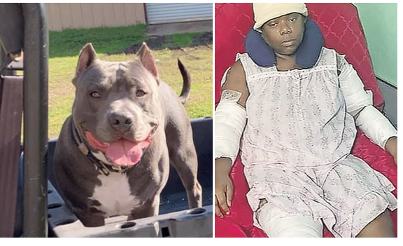 Pit Bull Attacks: Cancer Survivor Mauled, Baby Dies, as Wealthy Animal  Groups Fight Breed Specific Laws