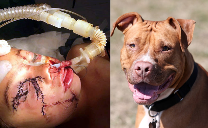 National Pit Bull Victims Awareness Day Focuses on Attacks, Deaths